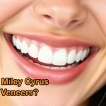 does Miley Cyrus have veneers